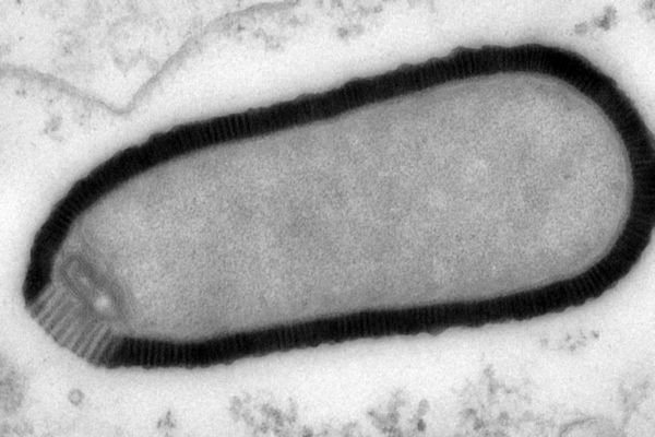 Imagem de microscópio mostra o vírus dentro de uma célula de ameba. Crédito: IGS, CNRS-AMU, Julia Bartoli, Chantal Abergel.